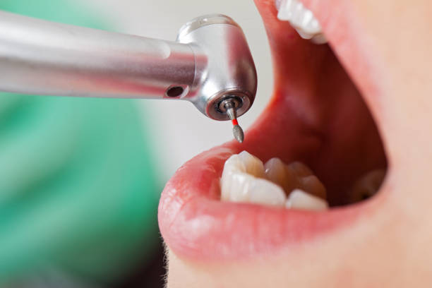 Best Emergency Denture Repair in Greendale, IN